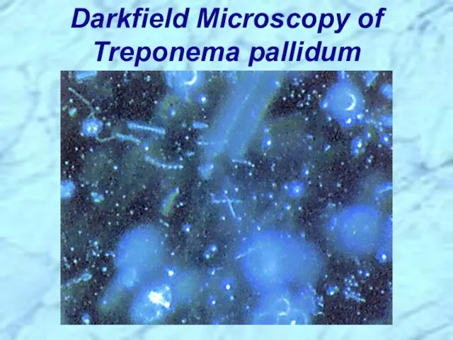 Darkfield Microscopy of Treponema pallidum