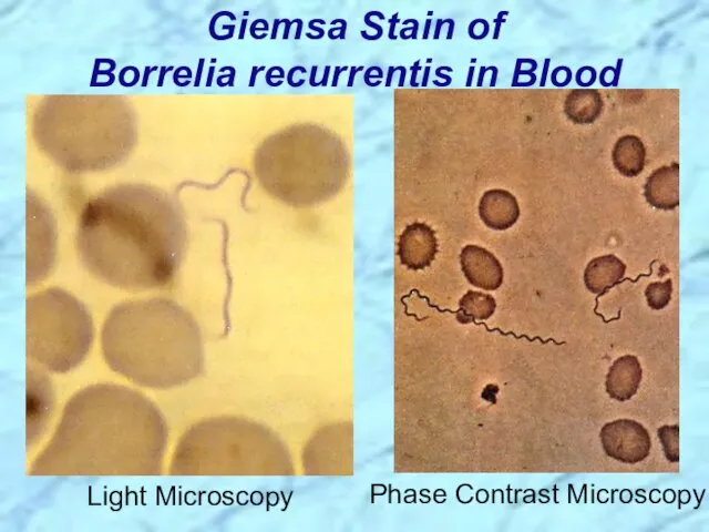 Giemsa Stain of Borrelia recurrentis in Blood Light Microscopy Phase Contrast Microscopy