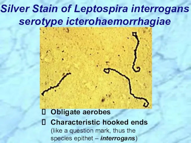 Silver Stain of Leptospira interrogans serotype icterohaemorrhagiae Obligate aerobes Characteristic