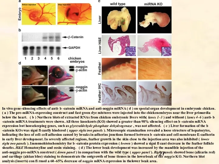 In vivo gene-silencing effects of anti- b -catenin miRNA and