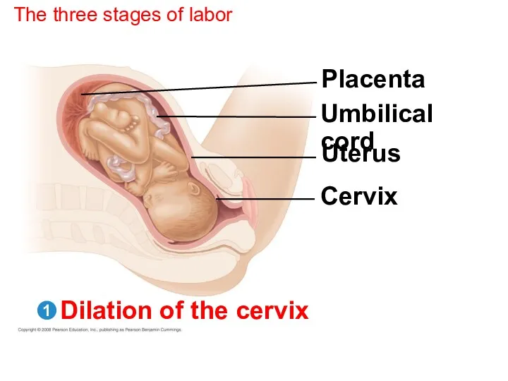 The three stages of labor Placenta Umbilical cord Uterus Cervix Dilation of the cervix 1