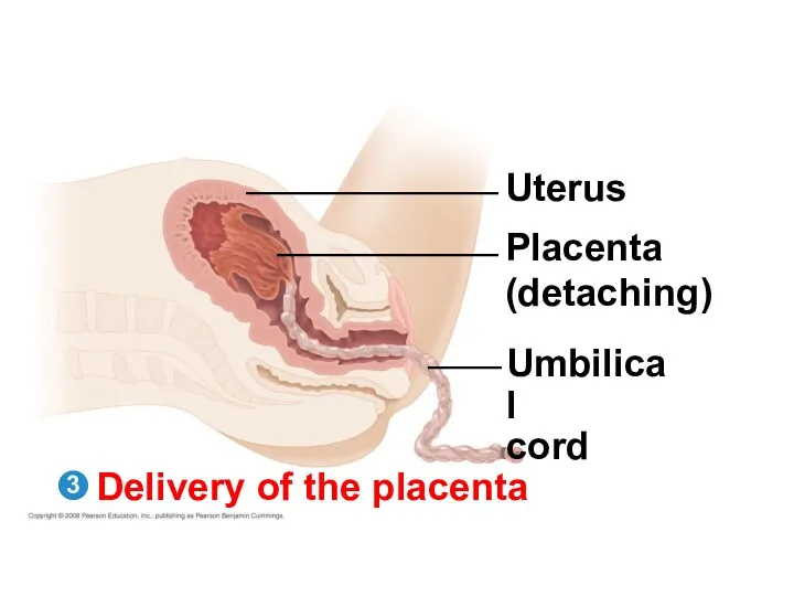 Delivery of the placenta Uterus Placenta (detaching) Umbilical cord 3
