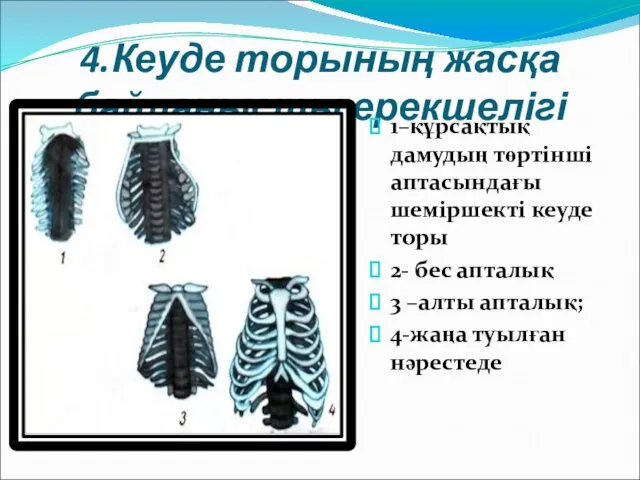 4.Кеуде торының жасқа байланысты ерекшелігі 1–құрсақтық дамудың төртінші аптасындағы шеміршекті