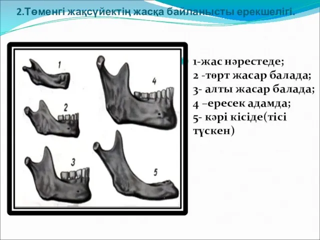 2.Төменгі жақсүйектің жасқа байланысты ерекшелігі. 1-жас нәрестеде; 2 -төрт жасар