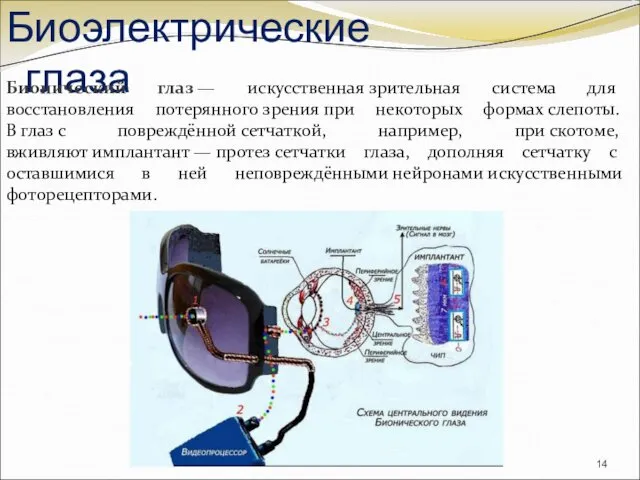 Биоэлектрические глаза Бионический глаз — искусственная зрительная система для восстановления