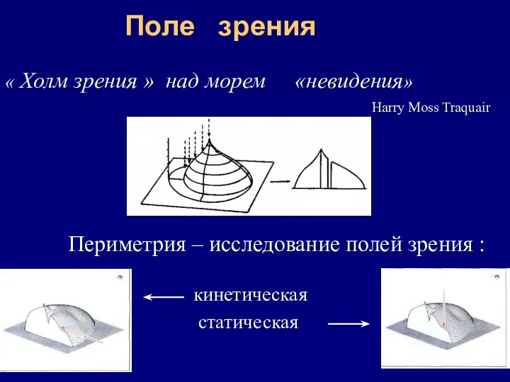 Поле зрения кинетическая статическая « Холм зрения » над морем