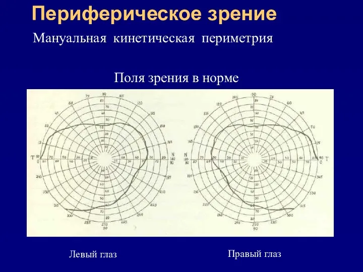 Периферическое зрение Мануальная кинетическая периметрия Поля зрения в норме Левый глаз Правый глаз