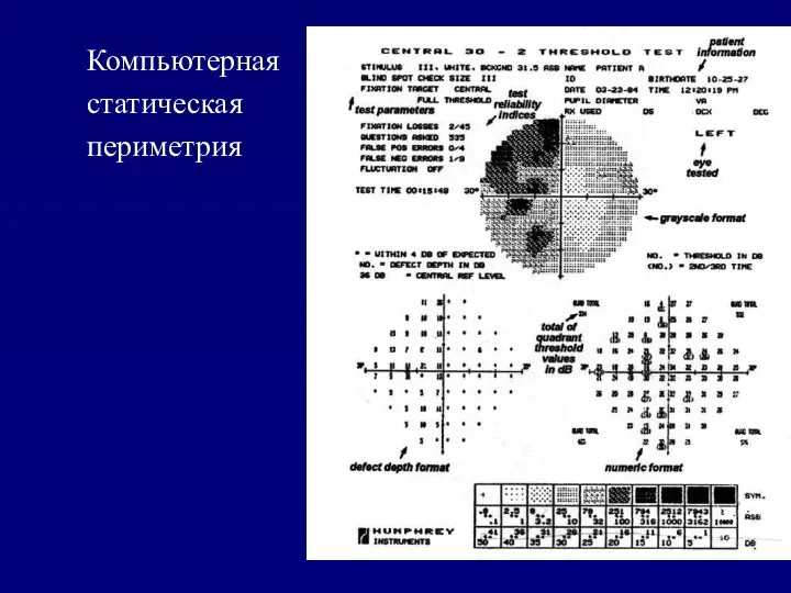 Компьютерная статическая периметрия