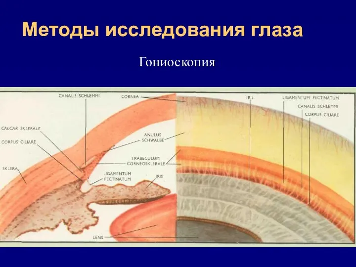 Методы исследования глаза Гониоскопия