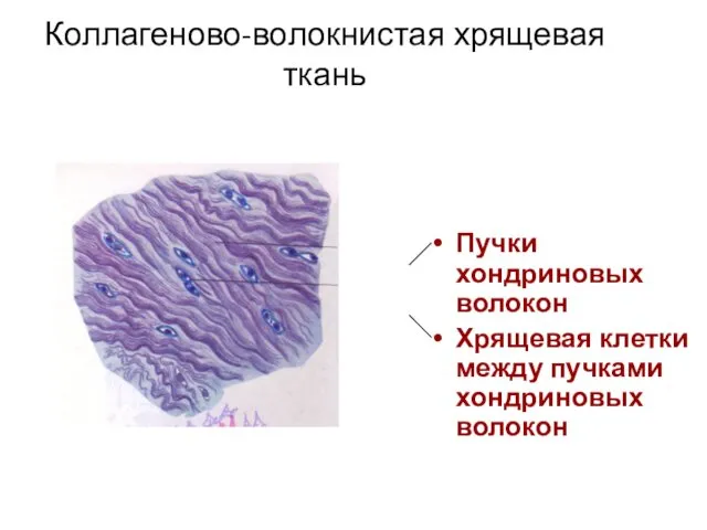 Коллагеново-волокнистая хрящевая ткань Пучки хондриновых волокон Хрящевая клетки между пучками хондриновых волокон