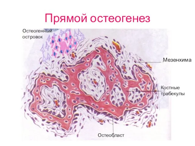 Прямой остеогенез Мезенхима Костные трабекулы Остеобласт Остеогенный островок