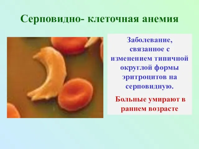 Серповидно- клеточная анемия Заболевание, связанное с изменением типичной округлой формы