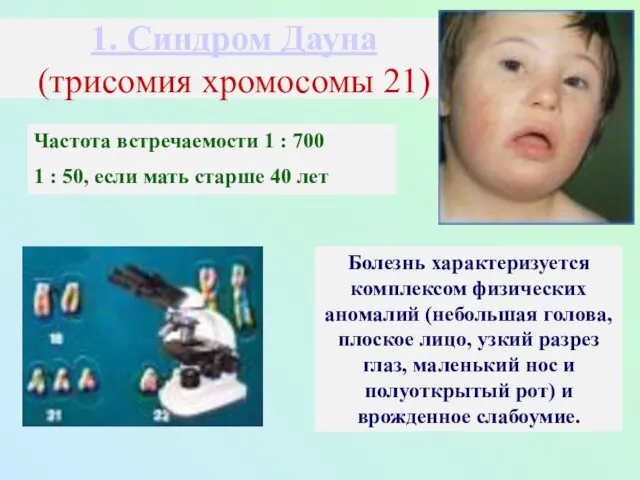 1. Синдром Дауна (трисомия хромосомы 21) Частота встречаемости 1 :