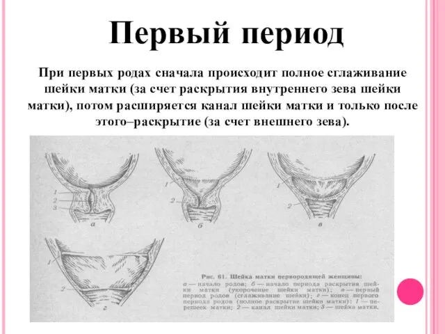 Первый период При первых родах сначала происходит полное сглаживание шейки