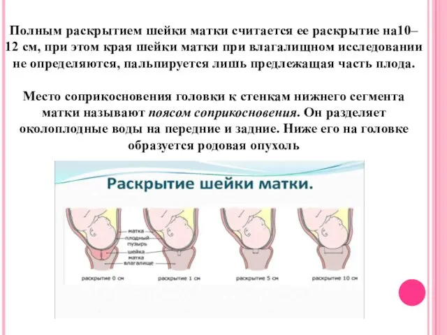 Полным раскрытием шейки матки считается ее раскрытие на10– 12 см,