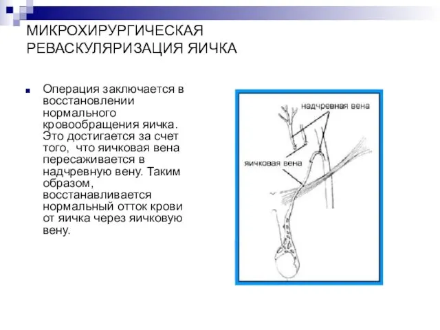 МИКРОХИРУРГИЧЕСКАЯ РЕВАСКУЛЯРИЗАЦИЯ ЯИЧКА Операция заключается в восстановлении нормального кровообращения яичка.