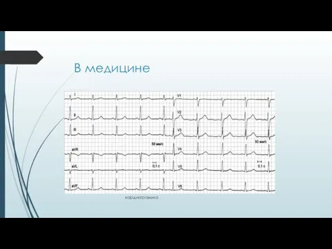 В медицине кардиограмма