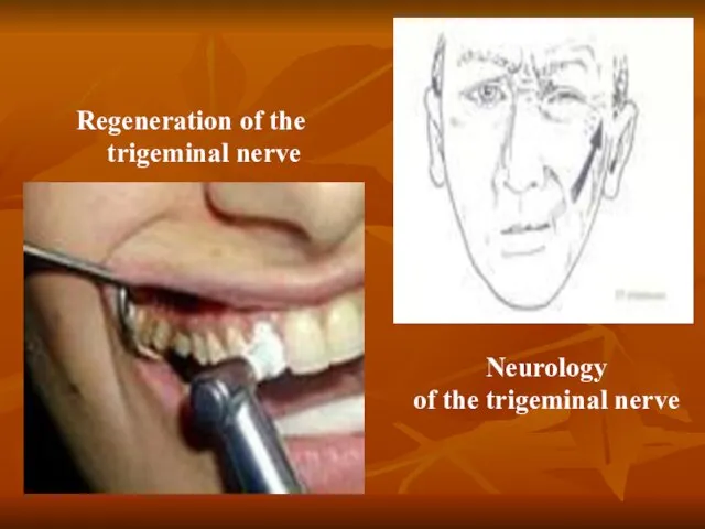 Regeneration of the trigeminal nerve Neurology of the trigeminal nerve