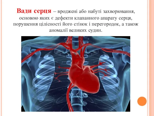 Вади серця – вроджені або набуті захворювання, основою яких є дефекти клапанного апарату
