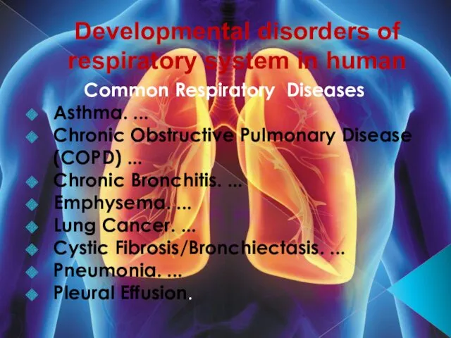 Developmental disorders of respiratory system in human Common Respiratory Diseases