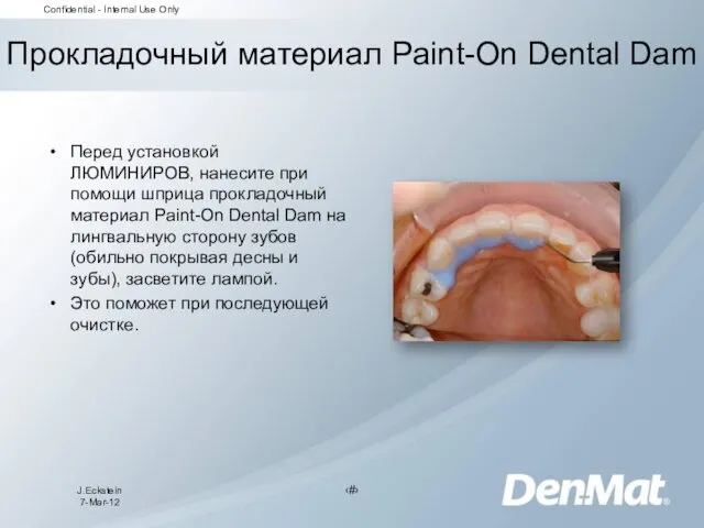 Прокладочный материал Paint-On Dental Dam Перед установкой ЛЮМИНИРОВ, нанесите при