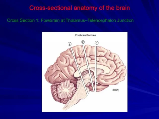 Cross-sectional anatomy of the brain Cross Section 1: Forebrain at Thalamus–Telencephalon Junction
