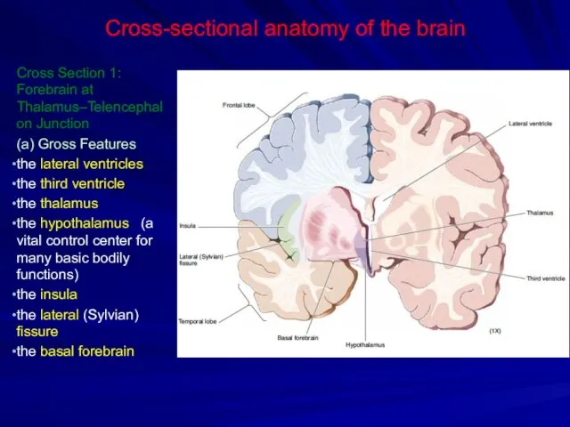 Cross-sectional anatomy of the brain Cross Section 1: Forebrain at