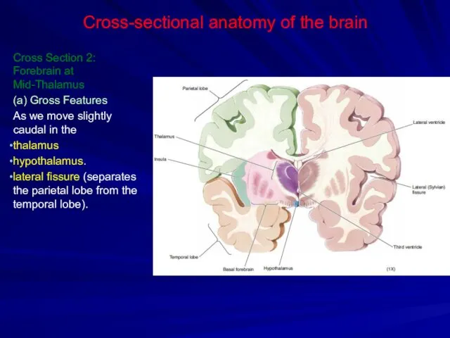 Cross-sectional anatomy of the brain Cross Section 2: Forebrain at