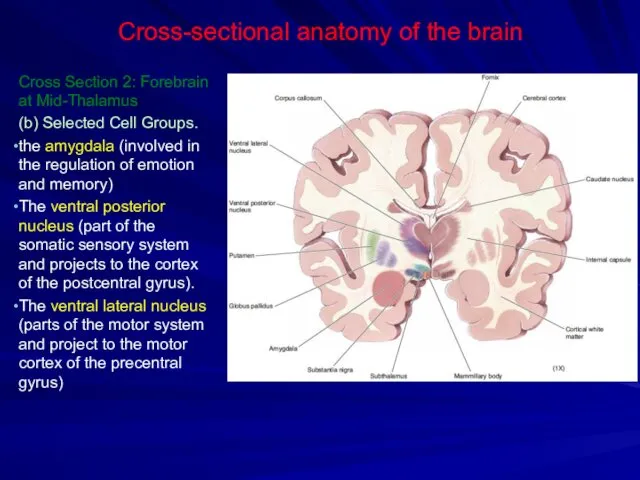 Cross-sectional anatomy of the brain Cross Section 2: Forebrain at