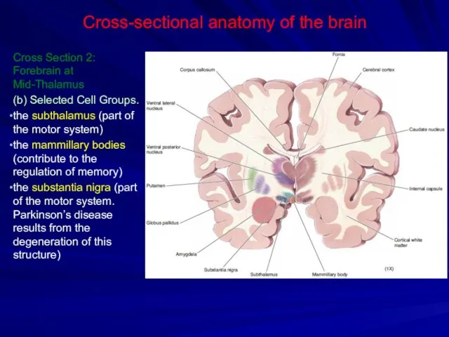 Cross-sectional anatomy of the brain Cross Section 2: Forebrain at