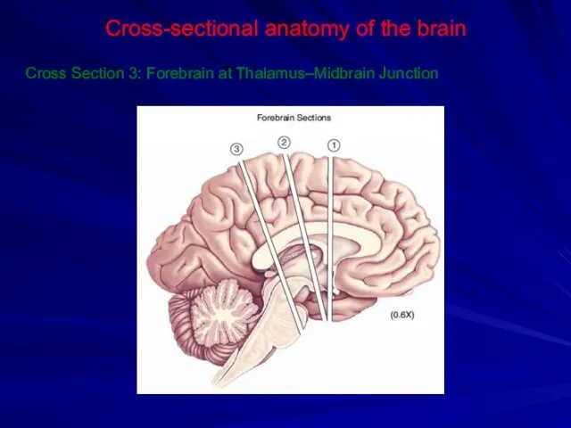 Cross-sectional anatomy of the brain Cross Section 3: Forebrain at Thalamus–Midbrain Junction