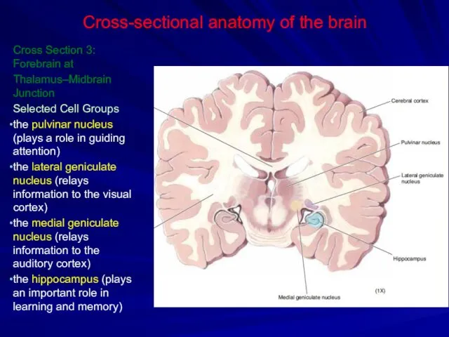 Cross-sectional anatomy of the brain Cross Section 3: Forebrain at