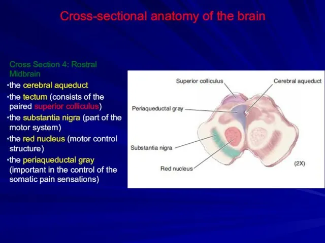 Cross-sectional anatomy of the brain Cross Section 4: Rostral Midbrain