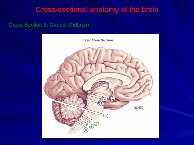 Cross-sectional anatomy of the brain Cross Section 5: Caudal Midbrain