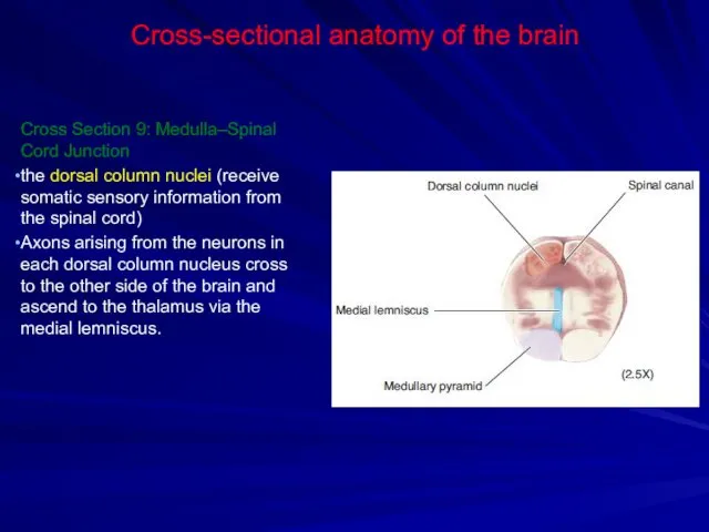 Cross-sectional anatomy of the brain Cross Section 9: Medulla–Spinal Cord