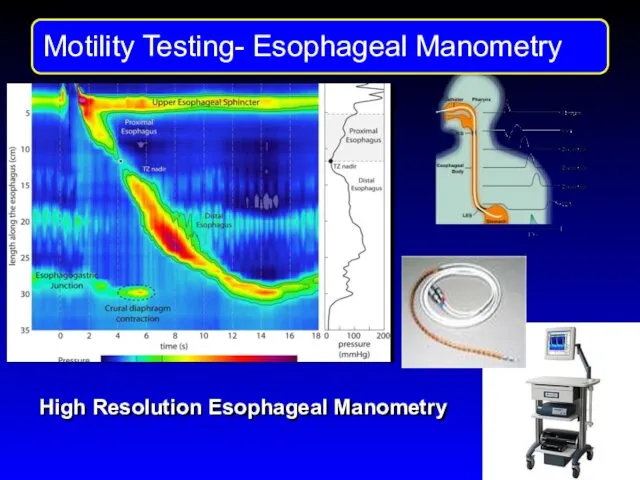 Motility Testng High Resolution Esophageal Manometry