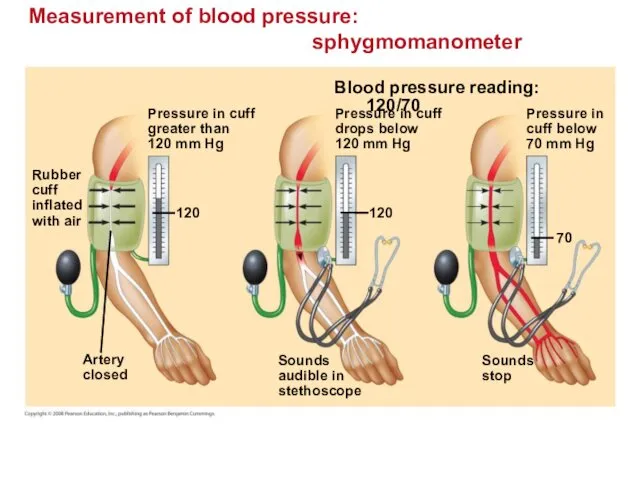Measurement of blood pressure: sphygmomanometer Pressure in cuff greater than