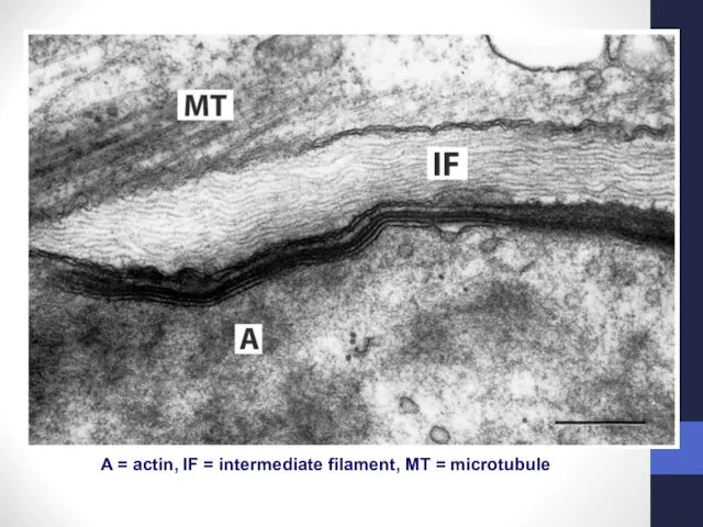 A = actin, IF = intermediate filament, MT = microtubule