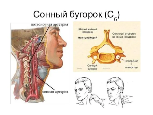 Сонный бугорок (С6)