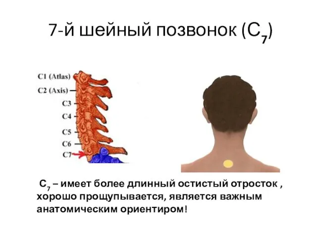 7-й шейный позвонок (С7) С7 – имеет более длинный остистый отросток , хорошо