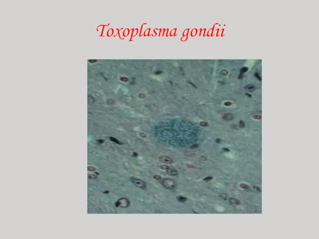 Toxoplasma gondii