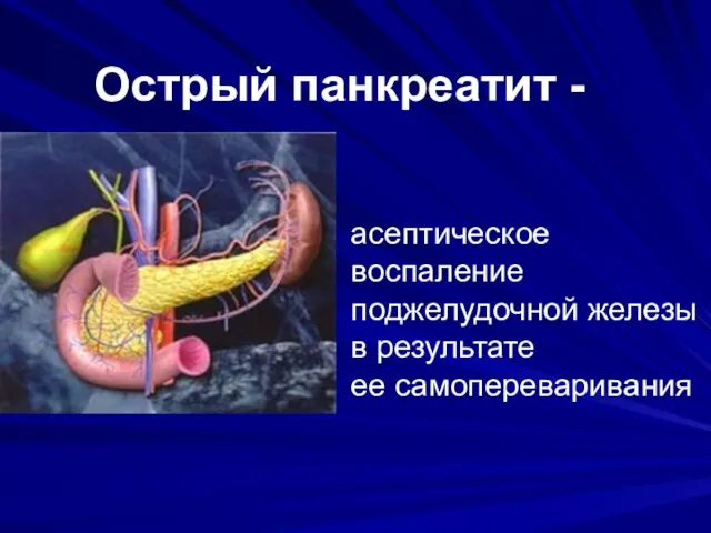 Острый панкреатит - асептическое воспаление поджелудочной железы в результате ее самопереваривания