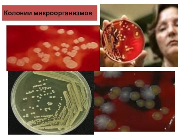 Колонии микроорганизмов