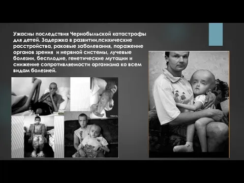 Ужасны последствия Чернобыльской катастрофы для детей. Задержка в развитии,психические расстройства, раковые заболевания, поражение