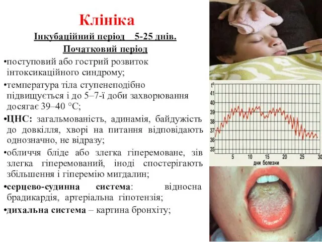 Клініка Інкубаційний період 5-25 днів. Початковий період поступовий або гострий