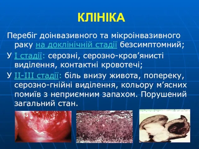 КЛІНІКА Перебіг доінвазивного та мікроінвазивного раку на доклінічній стадії безсимптомний;