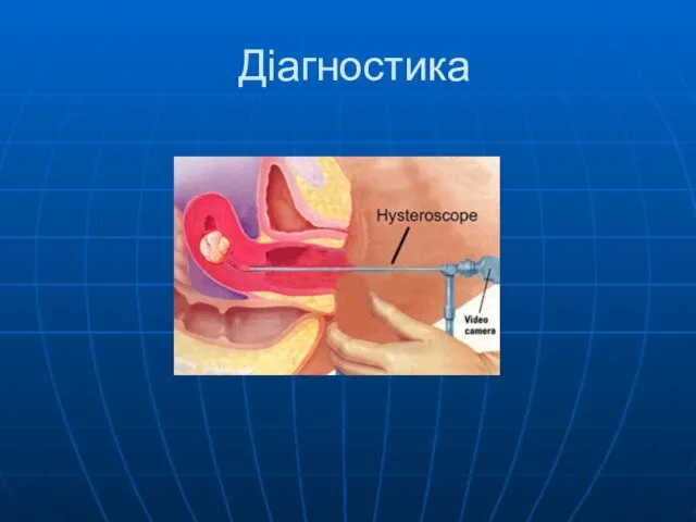 Діагностика