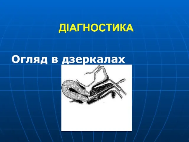 ДІАГНОСТИКА Огляд в дзеркалах