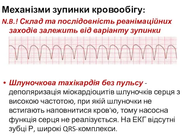 Механізми зупинки кровообігу: N.B.! Склад та послідовність реанімаційних заходів залежить