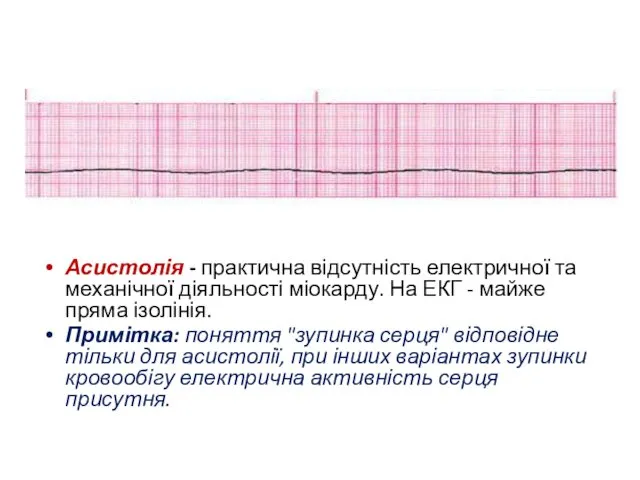 Асистолія - практична відсутність електричної та механічної діяльності міокарду. На